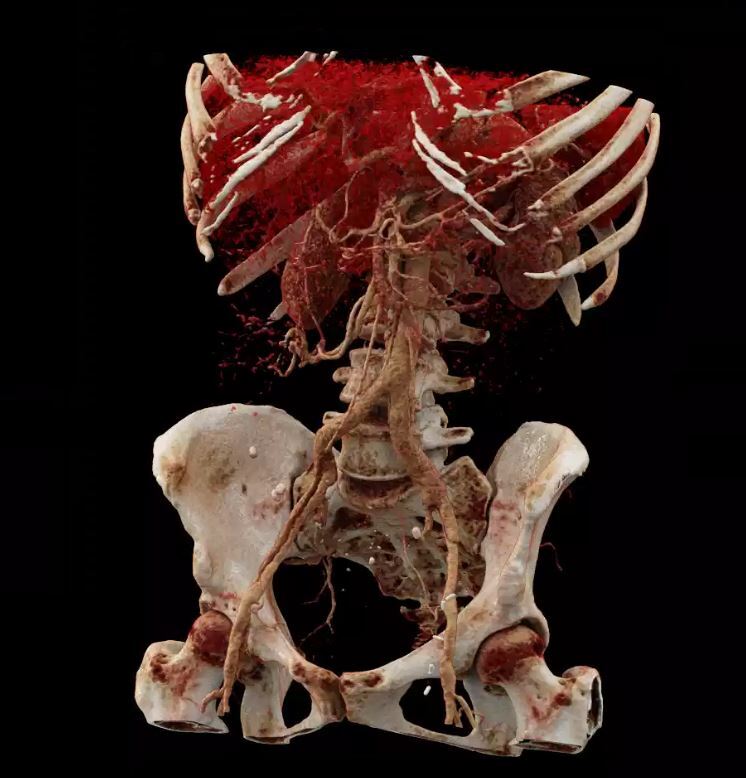 Pressefoto - Die moderne Bildgebung (Radiologietechnologie) von heute ermöglicht es, das Innere des menschlichen Körpers bis in kleinste Strukturen darzustellen. Fotocredit: FH Gesundheitsberufe OÖ 