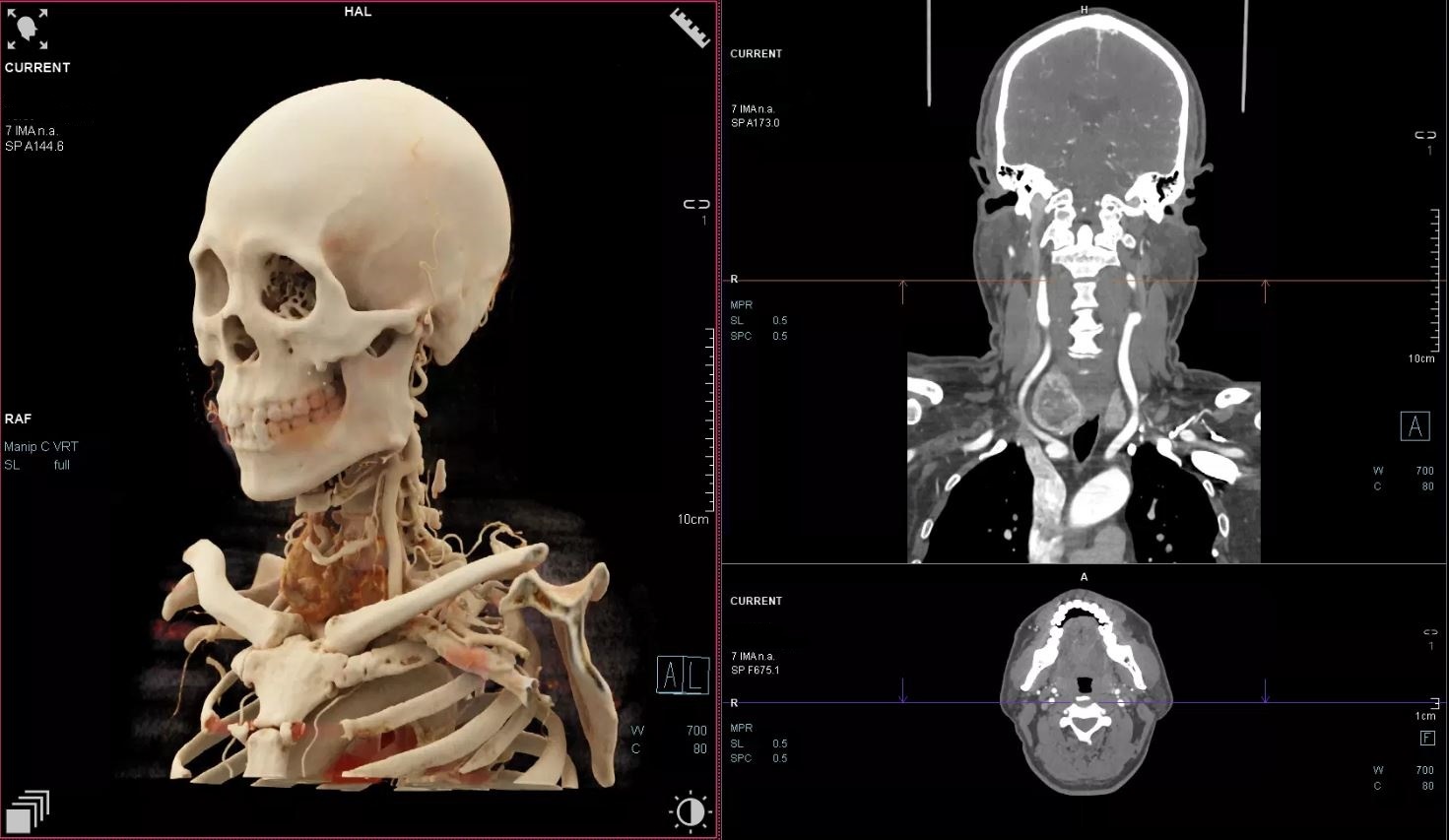 Aufnahme des SmartSimulators von Siemens Healthineers 