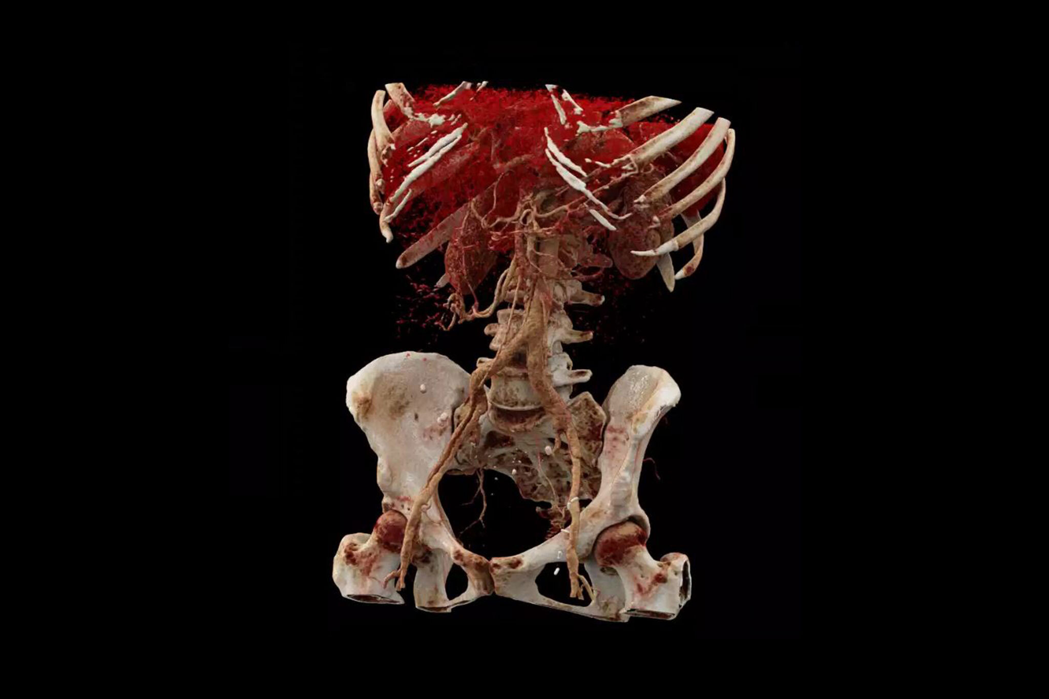 Pressefoto - Die moderne Bildgebung (Radiologietechnologie) von heute ermöglicht es, das Innere des menschlichen Körpers bis in kleinste Strukturen darzustellen. 